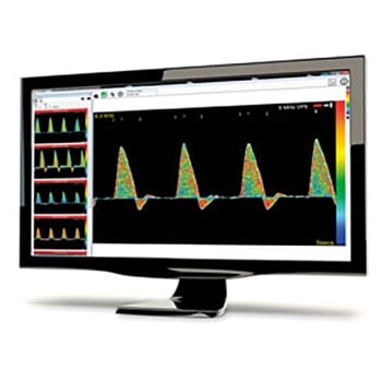 Huntleigh Dopplex DR5 Lite reporting software