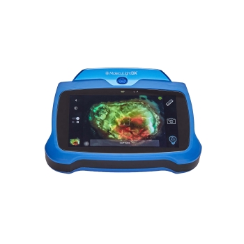 MolecuLightDX Wound Imaging Device
