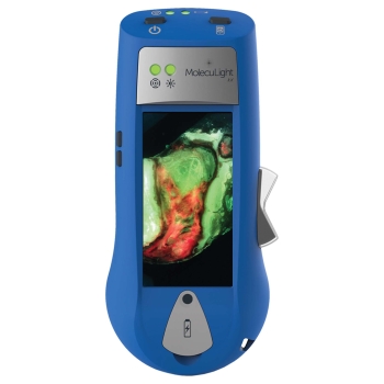 MolecuLight i:X Wound Imaging Device