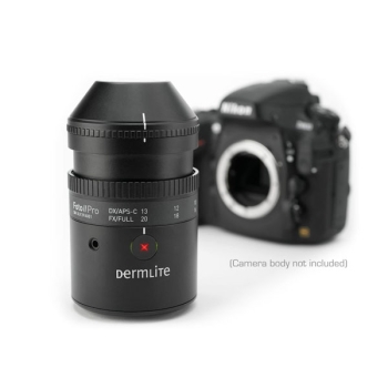 DermLite FOTO II Pro SLR Camera Lens