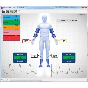 Dopplex Reporter Software Package