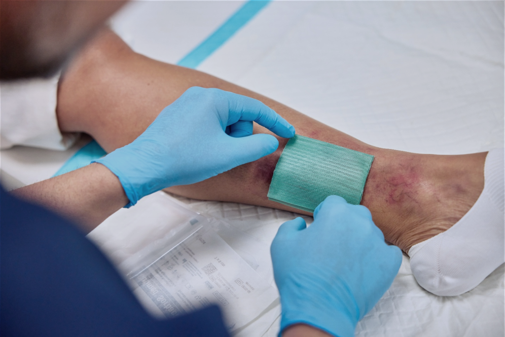 The Future of Wound Infection Management: Why Antimicrobial Stewardship Matters More Than Ever